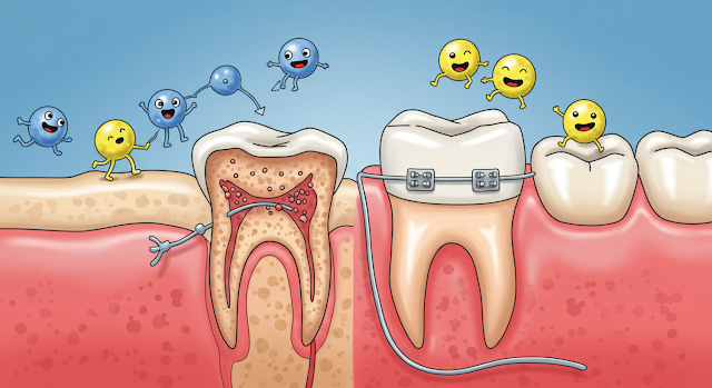 How Do Braces Work? The Surprising Science of Orthodontic Treatment